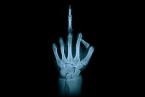 hand, middle finger, x-ray radiation